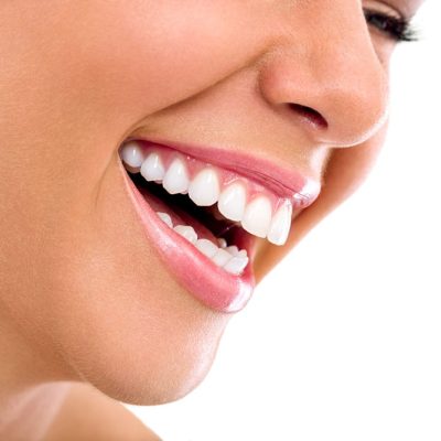 blanqueamiento-dental-para-mujeres.jpg